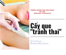 CẤY QUE TRÁNH THAI HIỆU QUẢ VÀ AN TOÀN CÁC BẠN ĐÃ BIẾT CHƯA?